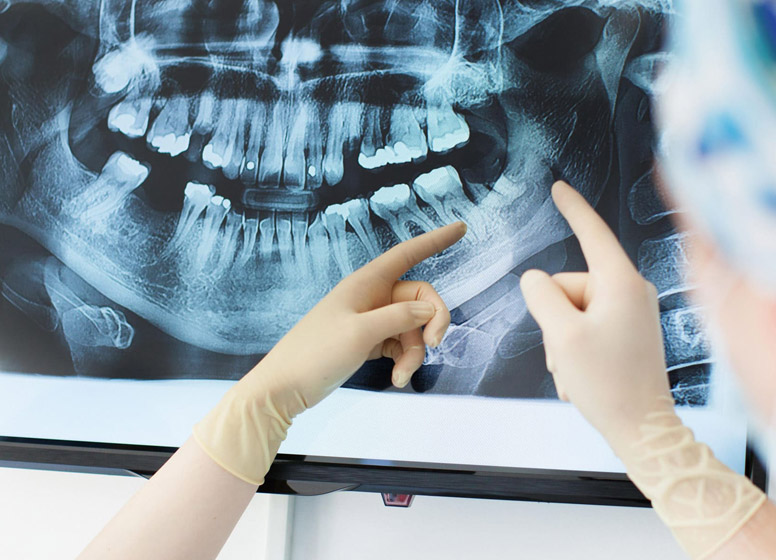 Radiologii dentare digitale