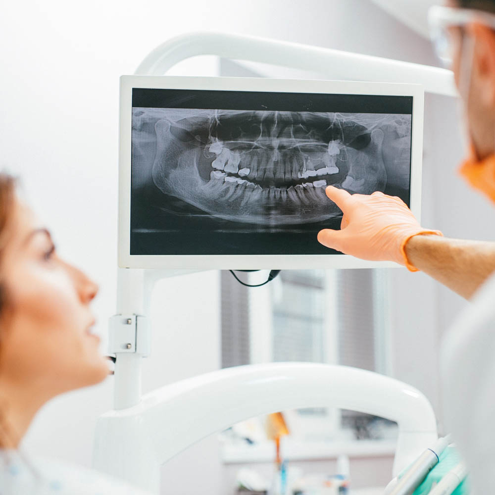 Aparatură radiografii dentare digitale 3D
