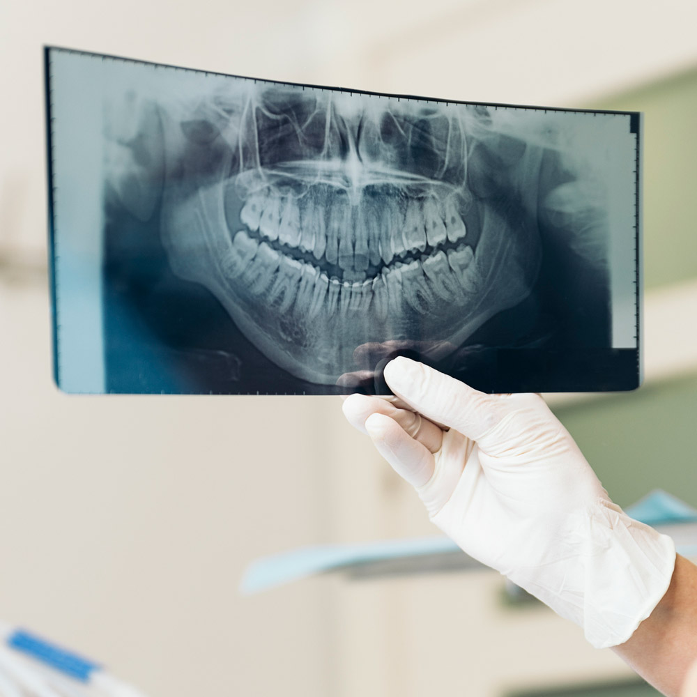 Radiografii dentare panoramice 3D