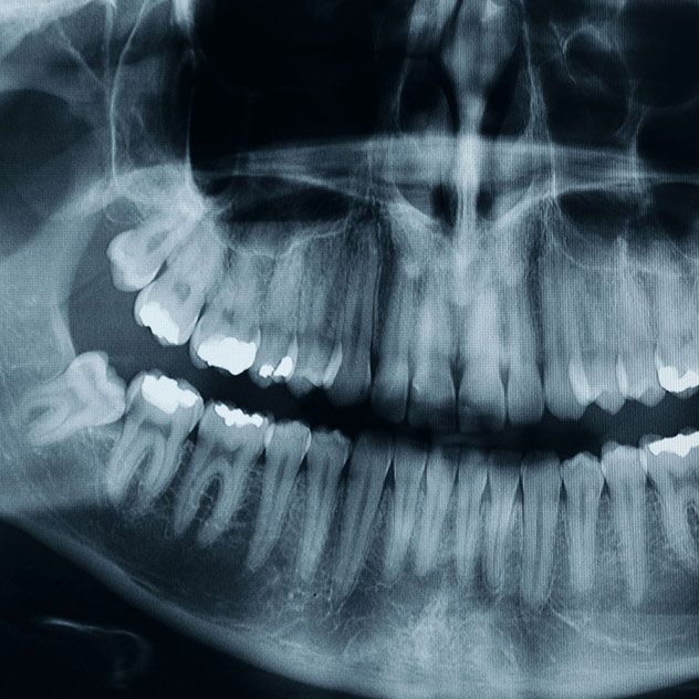 Programare Online Radiografia Gheţa