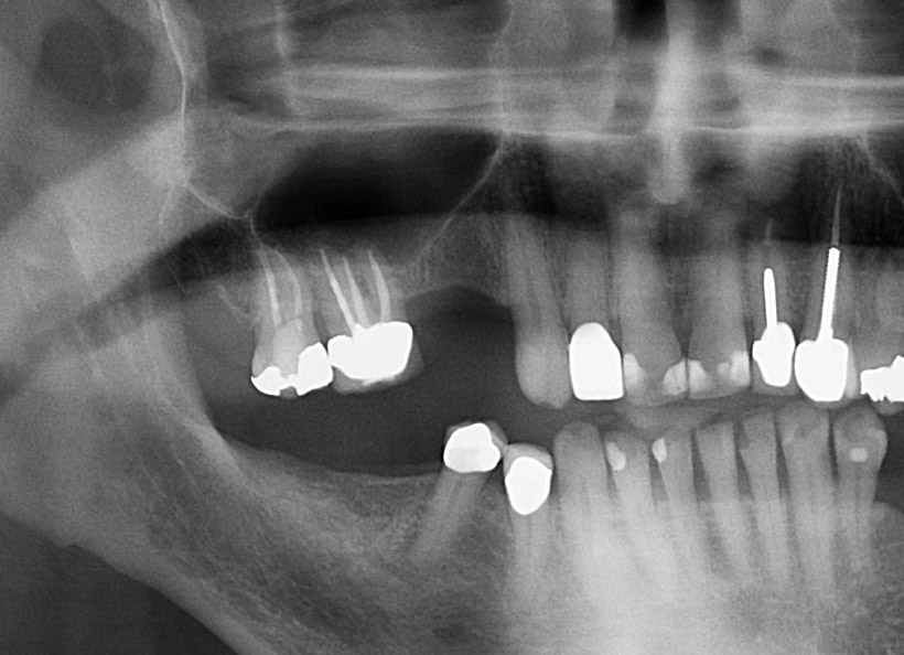 Radiografia digitală panoramică O.P.T. secţională