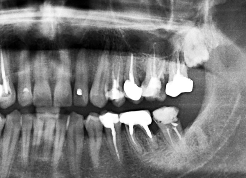 Radiografii digitale panoramice O.P.T. secţionale
